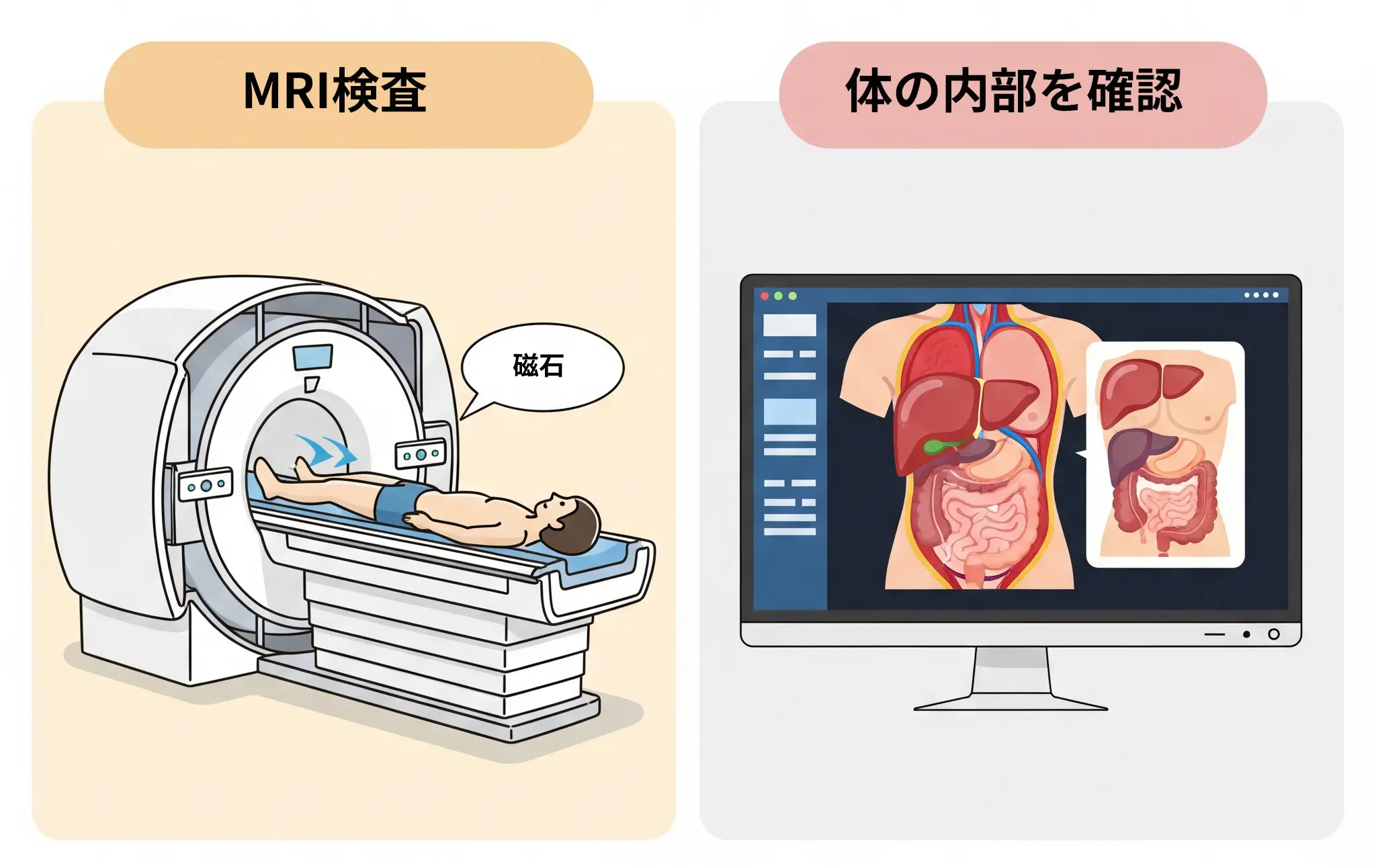 MRI装置のイラスト