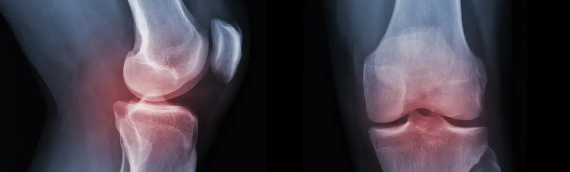 リウマチ科の画像