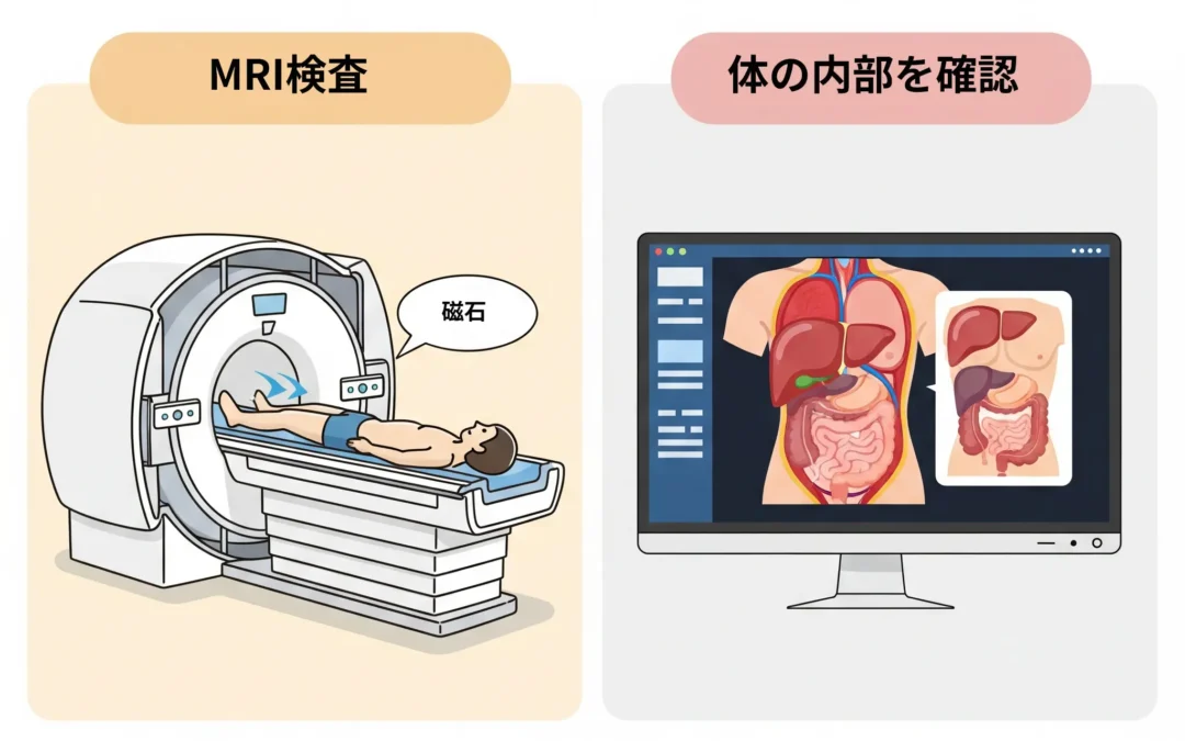 脳卒中について